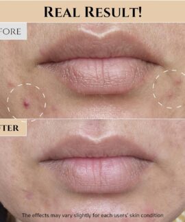 Beauty of Joseon Glow Replenishing Rice Milk Before and After Beauty of Joseon Glow Replenishing Rice Milk