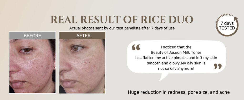 Beauty of Joseon Glow Replenishing Rice Milk Before and After Photo Beauty of Joseon Glow Replenishing Rice Milk