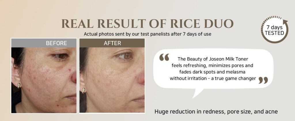 Beauty of Joseon Glow Replenishing Rice Milk Before and After Photo 2 Beauty of Joseon Glow Replenishing Rice Milk