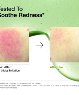 ANUA Azelaic Acid 10 Hyaluron Redness Soothing Serum Tested ANUA Azelaic Acid 10 Hyaluron Redness Soothing Serum