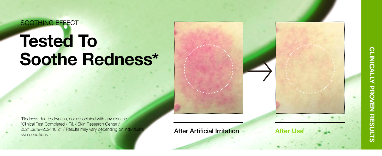 ANUA Azelaic Acid 10 Hyaluron Redness Soothing Serum Tested to Soothe ANUA Azelaic Acid 10 Hyaluron Redness Soothing Serum