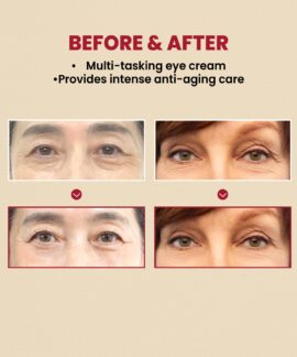 K SECRET SEOUL 1988 Eye Cream Retinal Liposome 4 Fermented Bean Before and After K-SECRET SEOUL 1988 Eye Cream : Retinal Liposome 4% + Fermented Bean