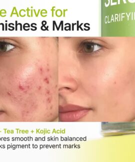 Purito Azelaic Acid 10 Kojic Tea Tree Serum For Blemishes and Marks Purito Azelaic Acid 10 Kojic Tea Tree Serum