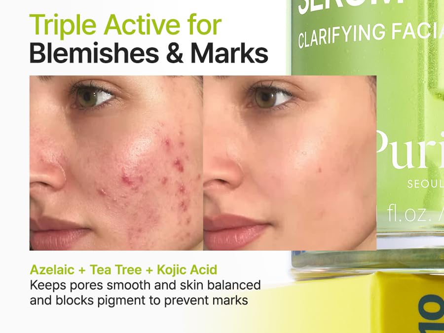 Purito Azelaic Acid 10 Kojic Tea Tree Serum - Image 4