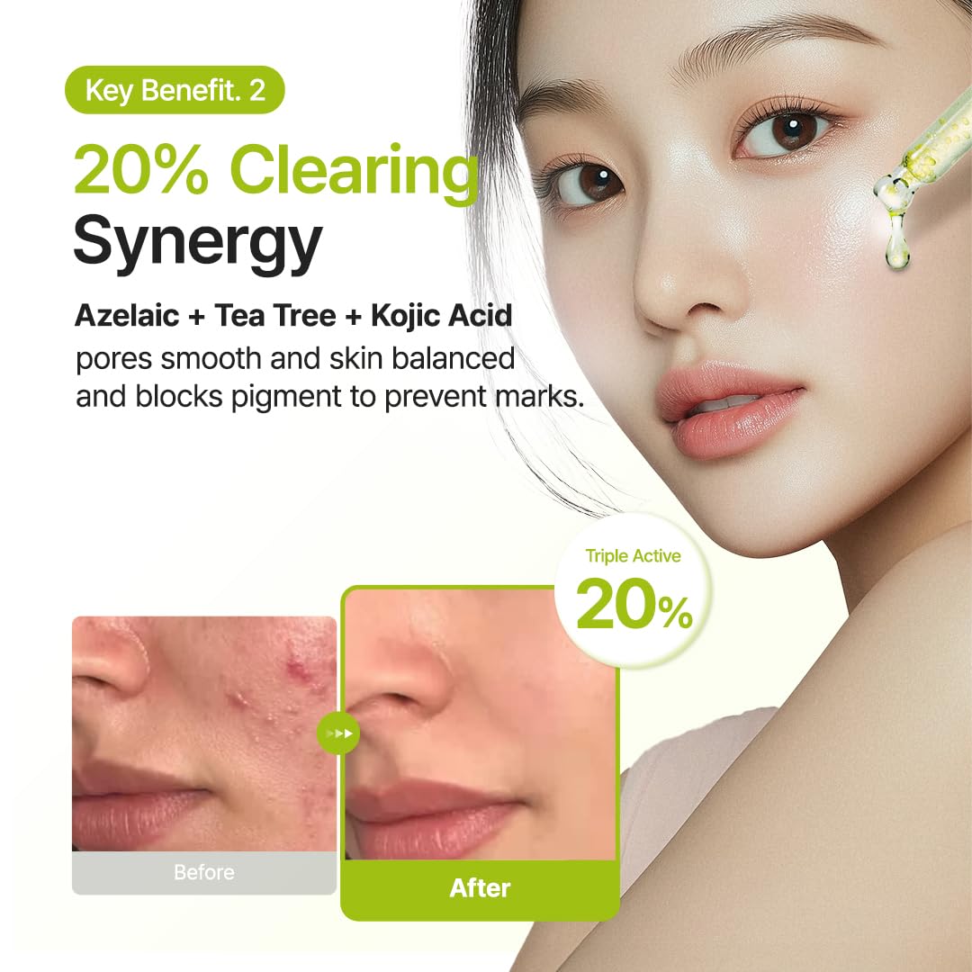 Purito Azelaic Acid 10 Kojic Tea Tree Serum - Image 7