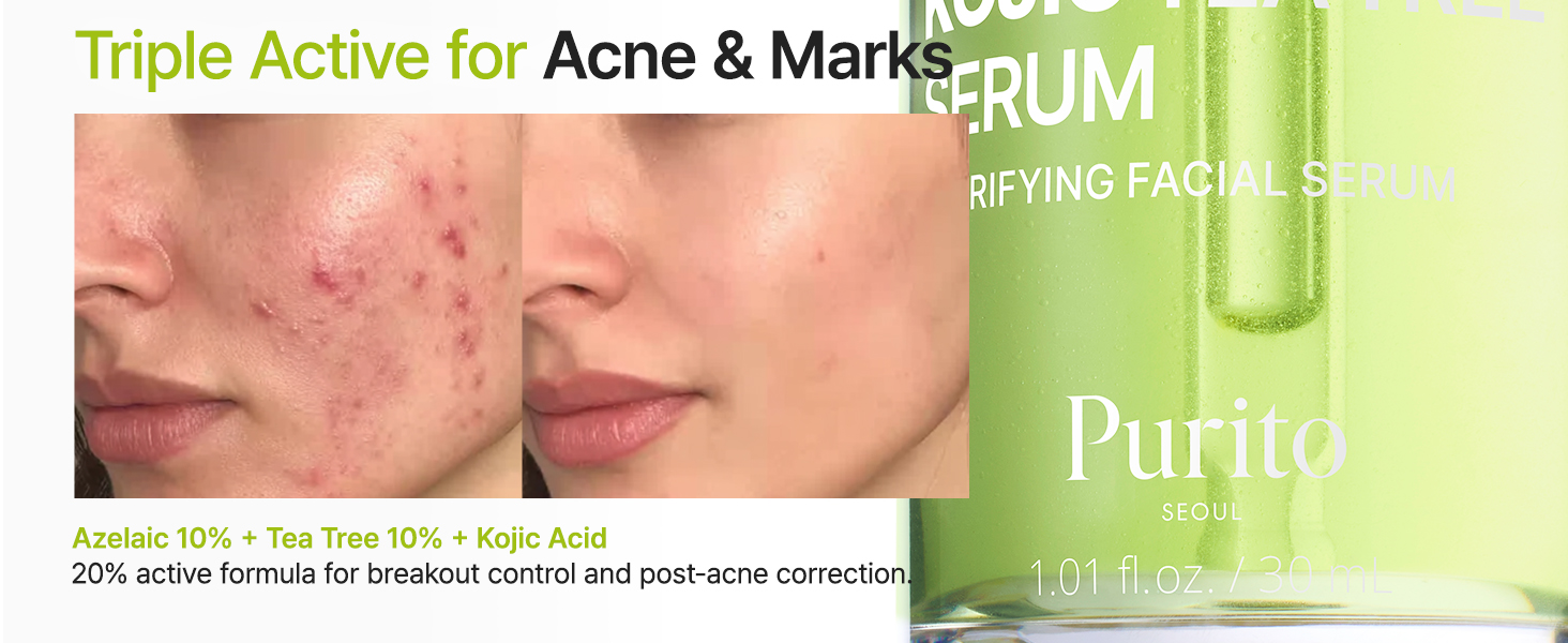 Purito Azelaic Acid 10 Kojic Tea Tree Serum Overview 4 Purito Azelaic Acid 10 Kojic Tea Tree Serum